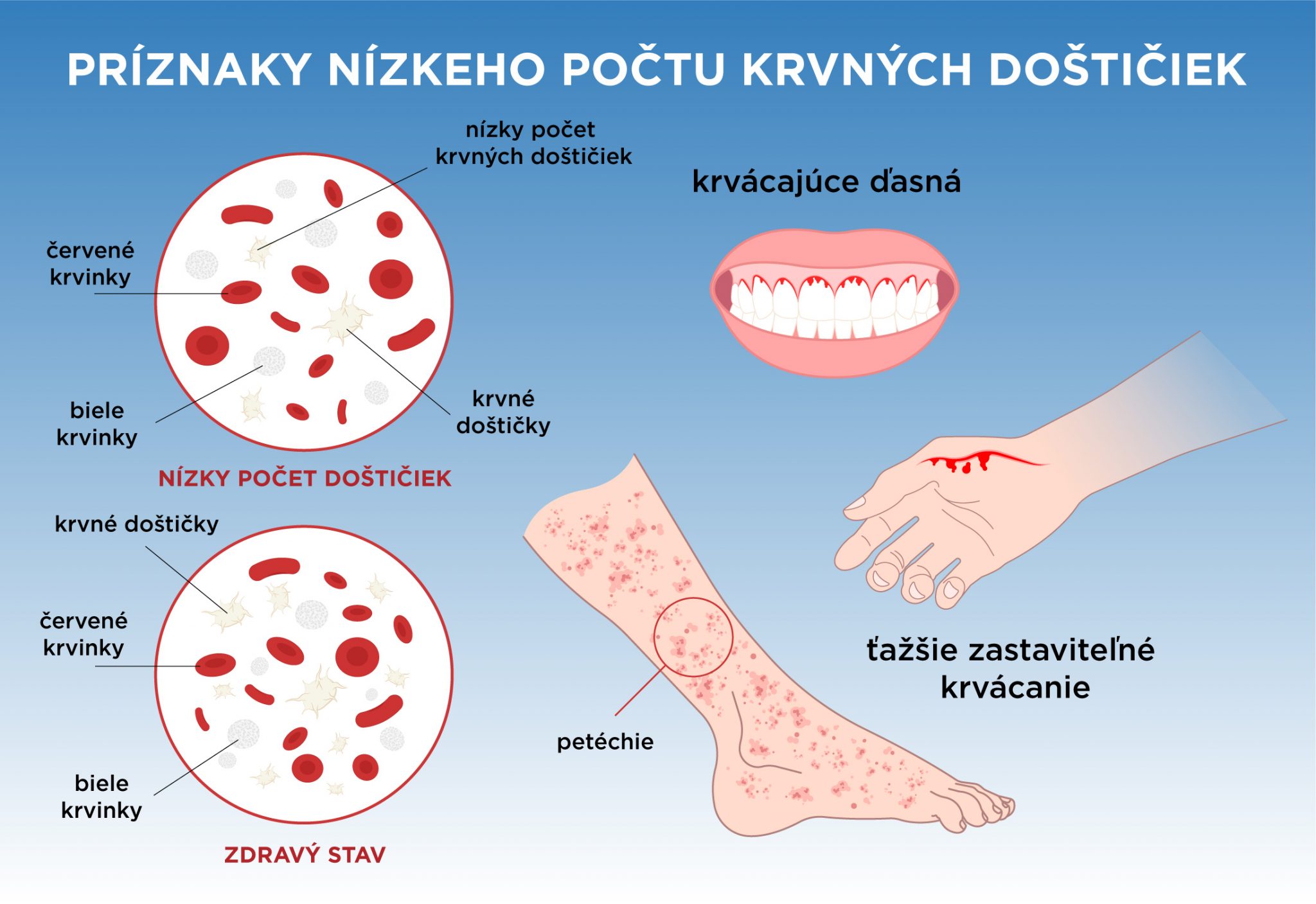 Pet Chie Erven Bodky Na Ko I Nepodce Ujte