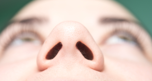 nádory nosa