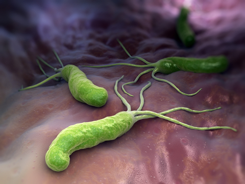 vredy žalúdka vredy dvanástnika Helicobacter Pylori