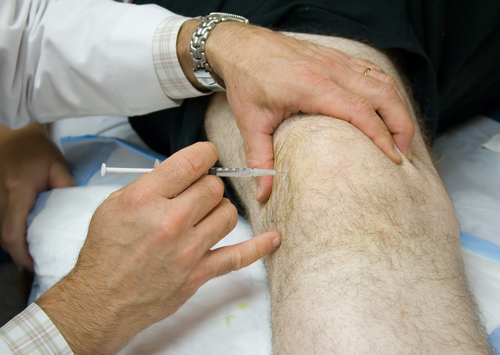 kyselina hyalurónová injekcie do kolena
